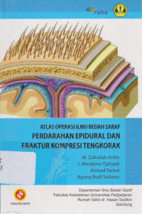 Atlas Operasi Ilmu Bedah Saraf Perdarahan epidural dan Fraktur  Kompresi Tengkorak