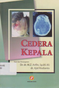 Cedera Kepala