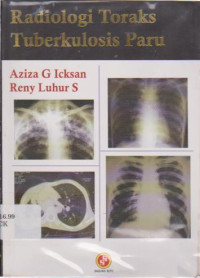 Radiologi Toraks Tuberkulosis Paru